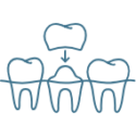 icon of tooth replacement